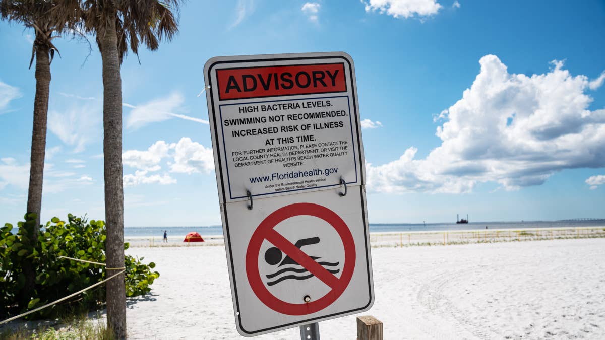 Flesh-Eating Bacteria Claims 5 Lives in Louisiana's Coastal Waters