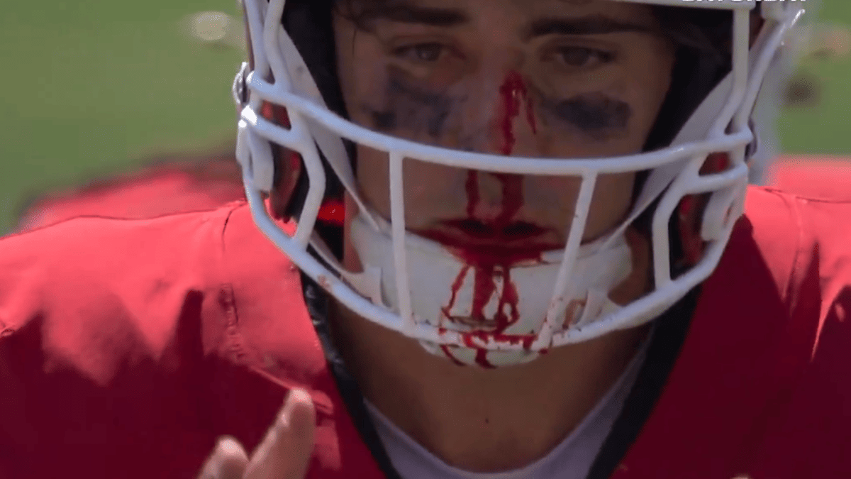 Hoover's Bloody Nose Can't Stop Indiana QB in Season Opener