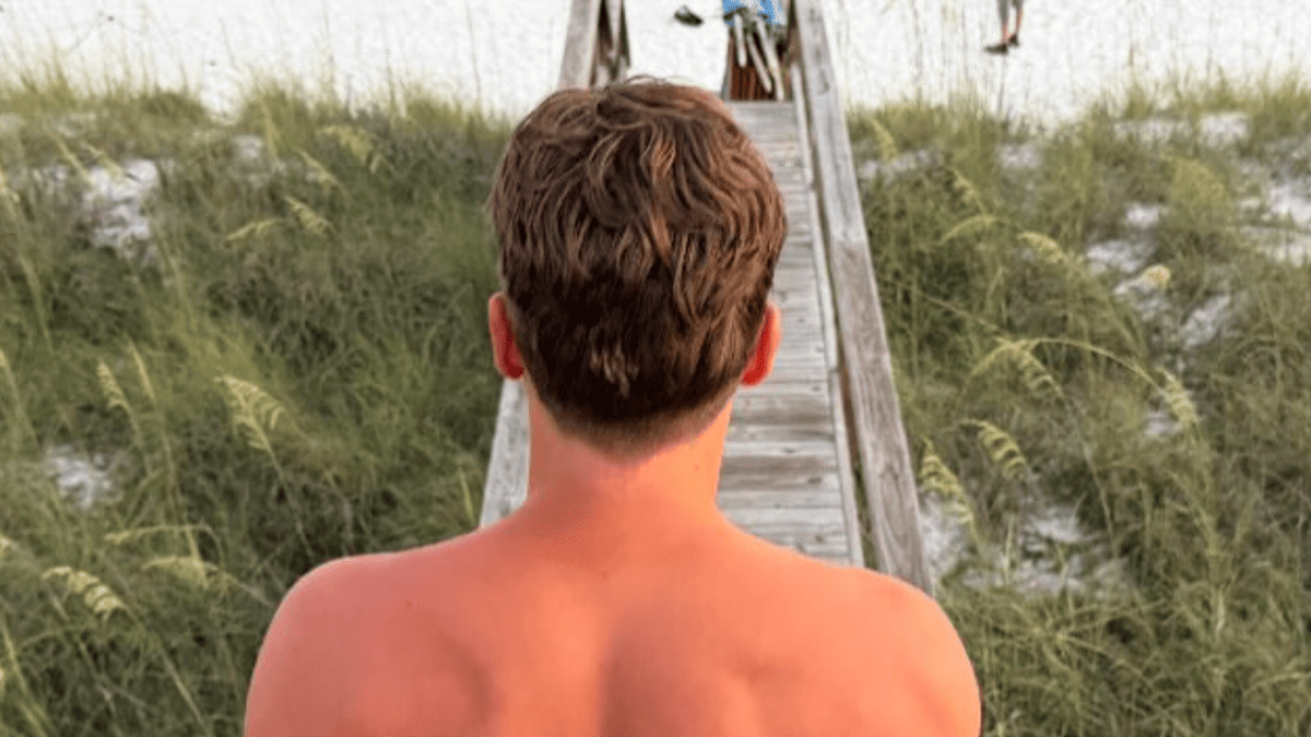 Joe Burrow's Shirtless Photo Sparks Buzz as Bengals QB Vows 'Battlefield' Return